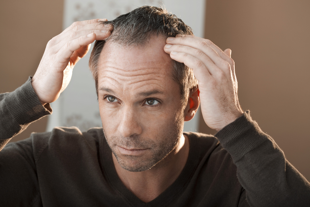 Confira 6 truques para combater a queda de cabelo masculino